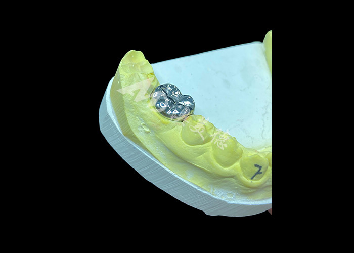Função duradoura Coroa fundida de metal durável para restauração de dentes superior