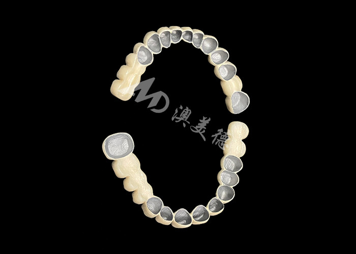 Porcelana personalizada fundida a ponte de coroa dental de metal para melhorar o sorriso natural