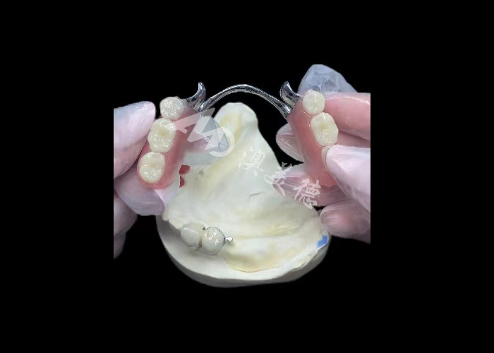 Porcelana durável fundida a metal coroa dental PFM coroa para restauração