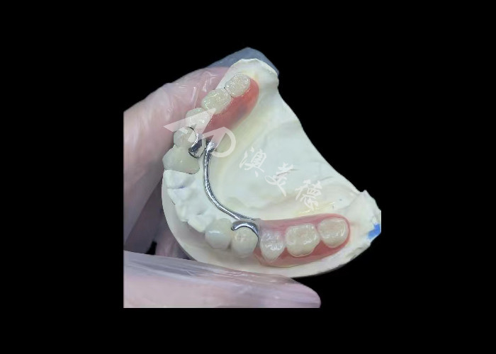 Porcelana durável fundida a metal coroa dental PFM coroa para restauração