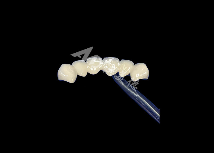 Porcelana biocompativel fundida com coroa de metal de alta durabilidade para melhor restauração