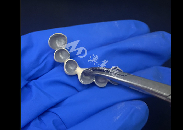 Porcelana biocompativel fundida com coroa de metal de alta durabilidade para melhor restauração