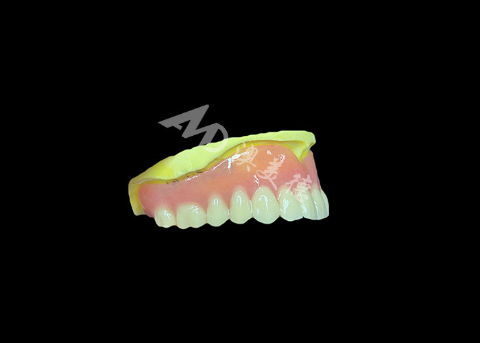 Dentes parciais fundidos fabricados para durabilidade conforto e estética e duração mais longa