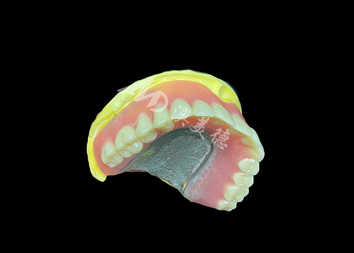 Dentes parciais fundidos fabricados para durabilidade conforto e estética e duração mais longa
