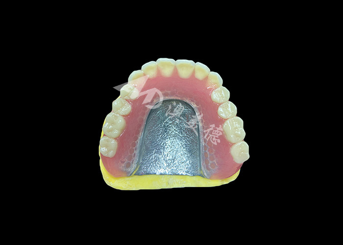 Dentes parciais fundidos fabricados para durabilidade conforto e estética e duração mais longa