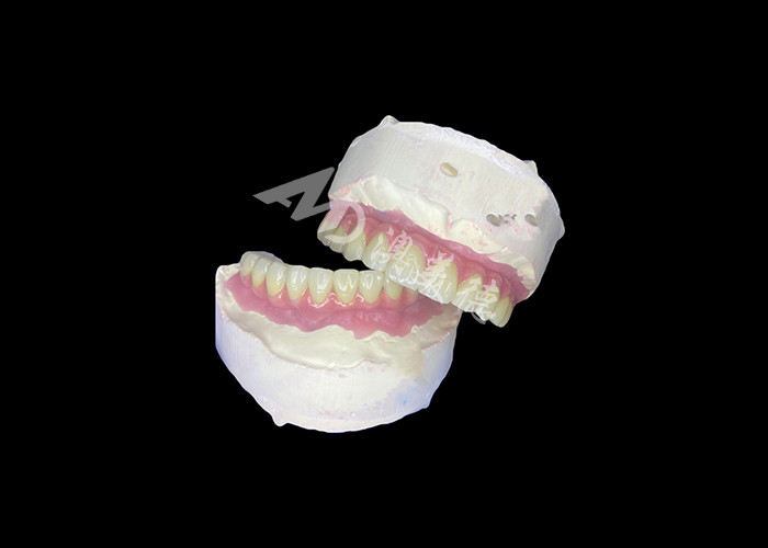 Dentistas All-on-6 Dental Implantes Dentários com Estabilidade e Conforto
