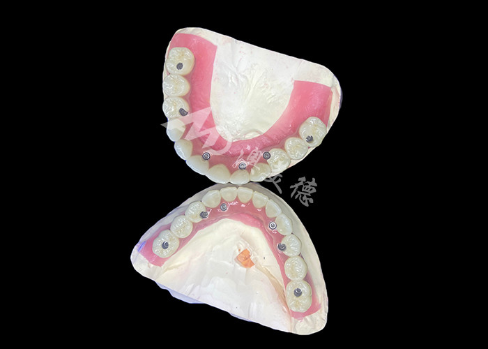 Dentistas All-on-6 Dental Implantes Dentários com Estabilidade e Conforto