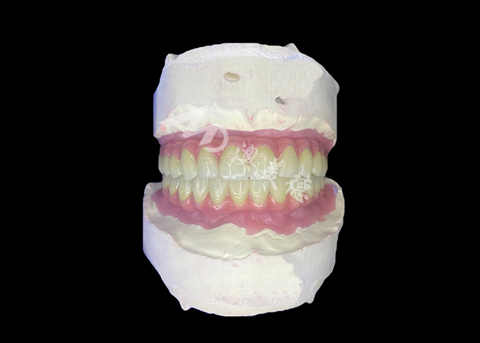 Dentistas All-on-6 Dental Implantes Dentários com Estabilidade e Conforto