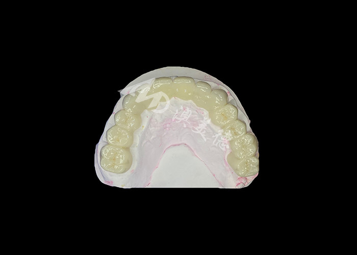 Ponte dental de zircônio de alta translucidez Forte e natural para restaurar o sorriso sem problemas