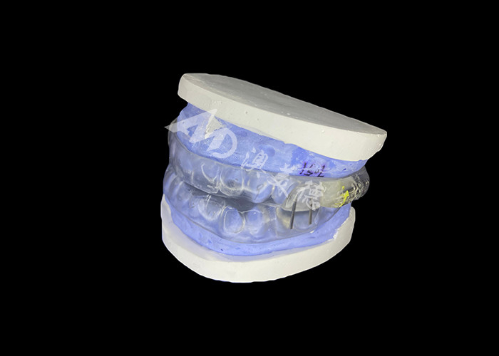 Dispositivo anti-ronco de tubarão Dispositivo de avanço mandibular ajustável para melhorar o alívio do ronco e melhorar o sono