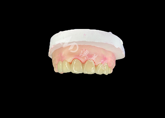 Wieland Zenostar Ceramic Crown Bridge Alta precisão para restaurações duradouras e de aparência natural