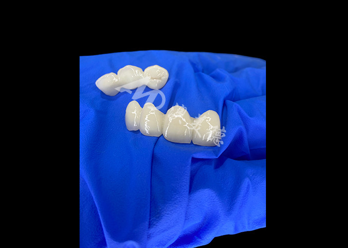 Wieland Zenostar Ceramic Crown Bridge Alta precisão para restaurações duradouras e de aparência natural