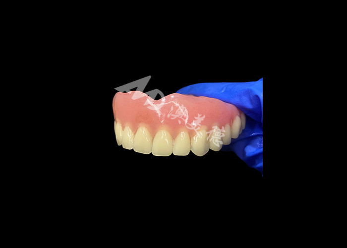 Dentadura Acrílica de Arco Completo Uma Solução Acessível para Necessidades Internacionais de Dentaduras Removíveis
