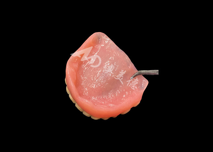 Dentadura Acrílica de Arco Completo Uma Solução Acessível para Necessidades Internacionais de Dentaduras Removíveis