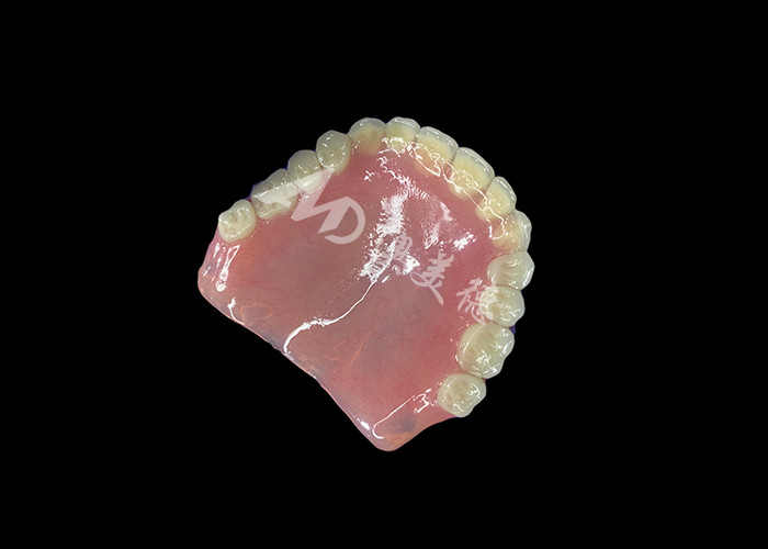 Dentadura Acrílica de Arco Completo Uma Solução Acessível para Necessidades Internacionais de Dentaduras Removíveis