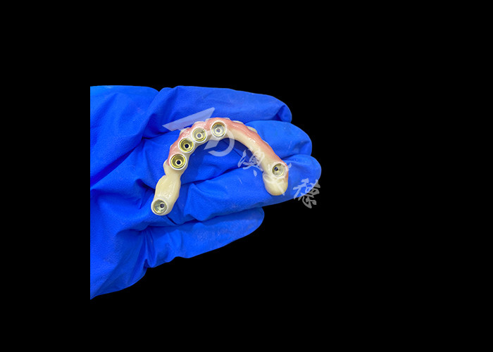 Abutment de titânio e implante de coroa de zircônio dentaduras apoiadas precisão adequado para uso confortável