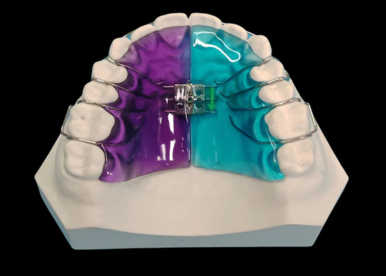 Bom preço Expansor Removível para Tratamento Ortodôntico e Melhoria do Sorriso on-line