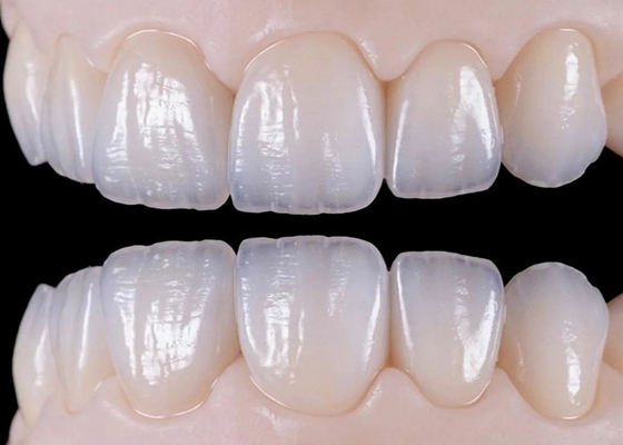 Bom preço Ponte de coroa dentária de cerâmica natural resistente ao desgaste para restauração natural on-line