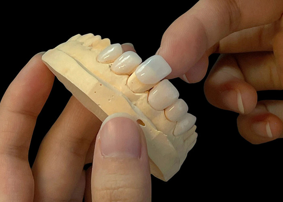 Bom preço Porcelana de sombra ultra fina Veneers EMAX resistente a manchas para restaurações estéticas on-line