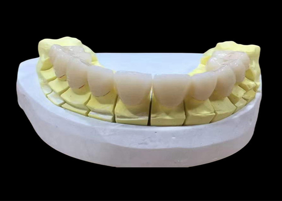 Bom preço Coroa dental de porcelana de zircônio com acabamento estético e de aparência natural do laboratório dentário da China on-line