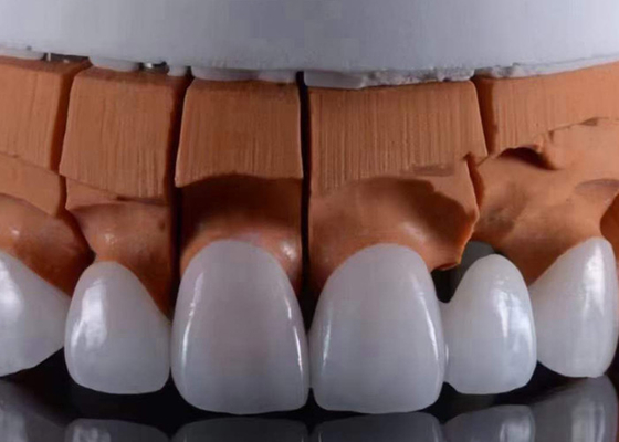 Bom preço FDA aprovado coroas dentárias de zircônio translúcidas on-line