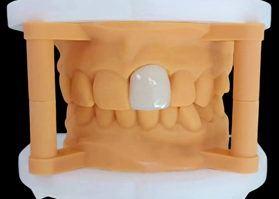 Bom preço Coroa dental de zircônio translúcido com desempenho estético do laboratório dentário da China on-line