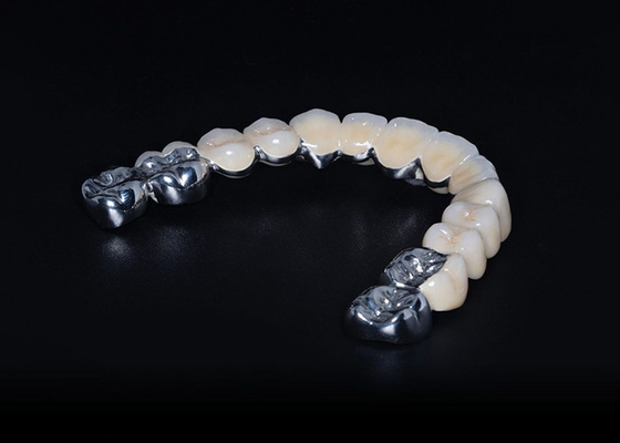 Bom preço Porcelana biocompativel de alta durabilidade fundida com coroa de metal on-line
