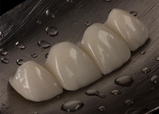 Bom preço Ponte de coroa de cerâmica personalizável para dentes perdidos Confortável e perfeito on-line