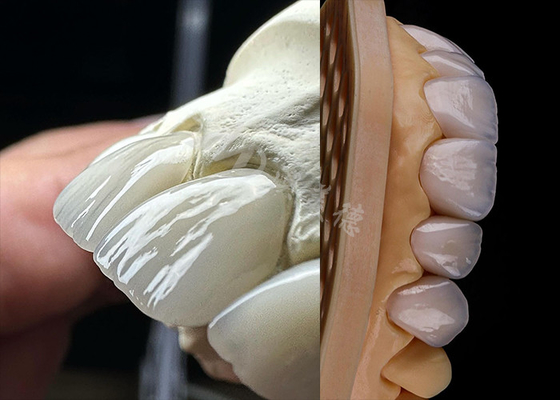 Bom preço Dentes duradouros, coroa de zircônio sólida, dentes de coroa precisos, laboratório de circônio. on-line