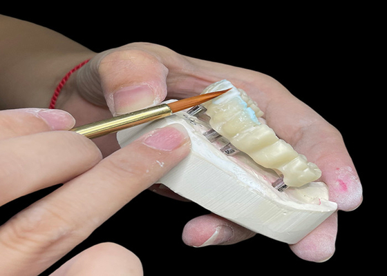Bom preço Implante dentário polido personalizável ponte coroa durável para higiene fácil on-line