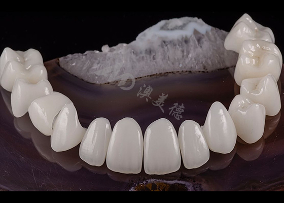 Bom preço Dente Dental Translúcido Coroneta de Zircônio Sólido Estética Natural Resistência a Rasgaduras on-line