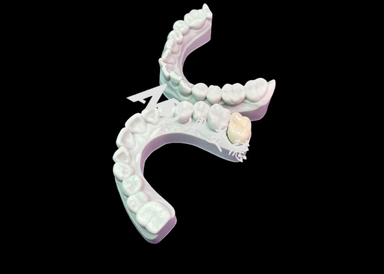 Bom preço Corrida precisa Coroa dental de zircônio Estética Cor natural Excelente biocompatibilidade on-line
