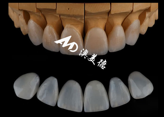 Bom preço Finete dental em Emax/porcelana para odontologia cosmética altamente preciso e personalizado on-line