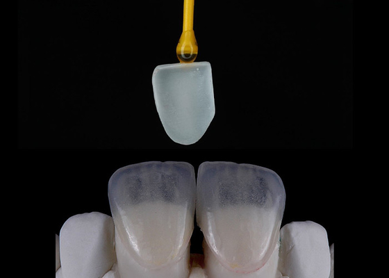 Bom preço Restauração dental feita sob encomenda Veneers EMAX Impressão digital lindamente alinhada on-line