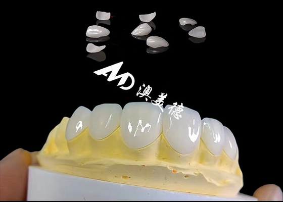 Bom preço Translucidez IPS Emax Veneers, Preparação mínima Emax Veneers Dental on-line