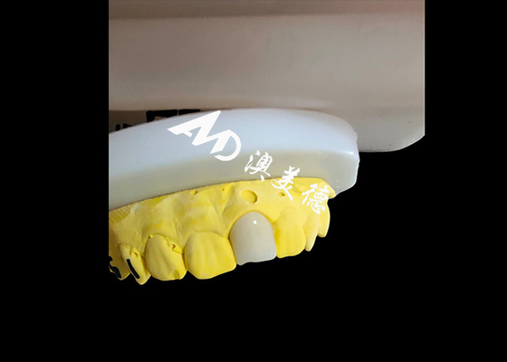 Bom preço Coronas Dentárias de Circônia de Aparência Natural Estética Restauração de Dentes de Ajuste Incomparável on-line