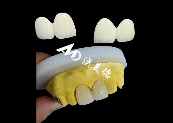 Bom preço Coroa Dental de Circônio Personalizada Capuz Dental de Adequação Precisa do Laboratório Dental da China on-line