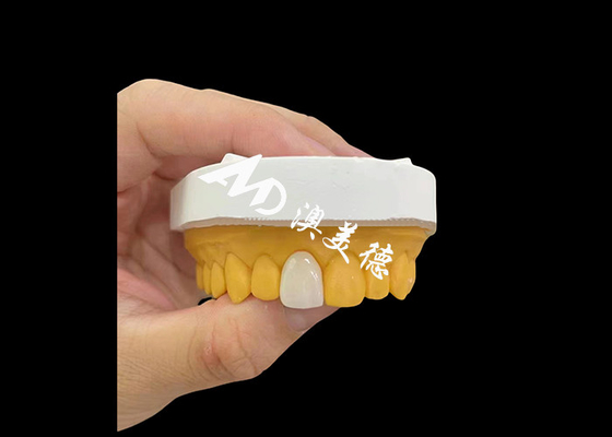 Bom preço Incisivo anterior Coroa dentária de zircônio Natural de aparência resistência ao desgaste on-line