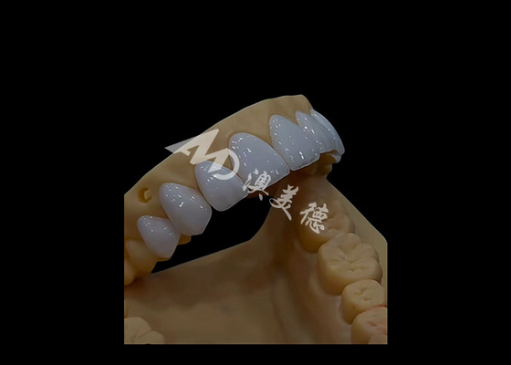 Bom preço Prótese Dentária Circônia Coroa Dentária Adequação Precisa Estética Para Dentes de Arco Completo on-line