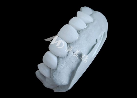 Bom preço Coroa dental de zircônio que oferece força imbatível e suavidade natural, e translucidez natural. on-line