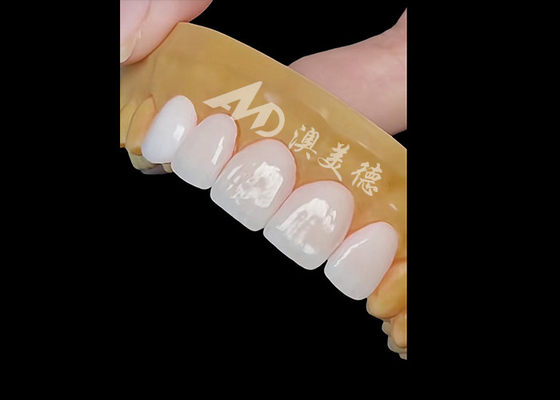 Bom preço Coroa de zircônio dental de precisão para restauração natural e duradoura on-line