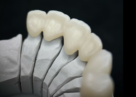 Bom preço Coroa dental de zircônio sólido, com uma resistência excepcional e uma estética natural on-line