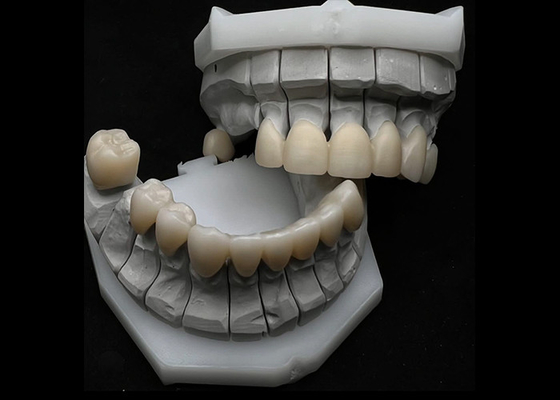 Bom preço Resistência à ruptura da coroa dental de zircônia para dentes únicos ou múltiplos on-line