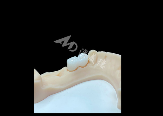 Bom preço Coroa de zircônio sólido de alta qualidade para restaurações dentárias satisfatórias on-line