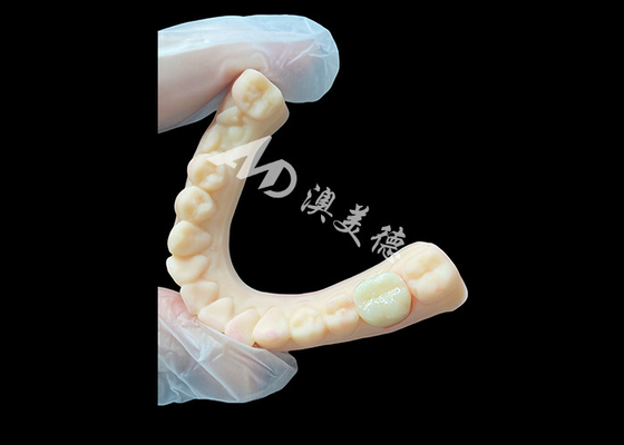 Bom preço Alta resistência cerâmica de zircônio coroa dental posterior superior estética e durabilidade on-line