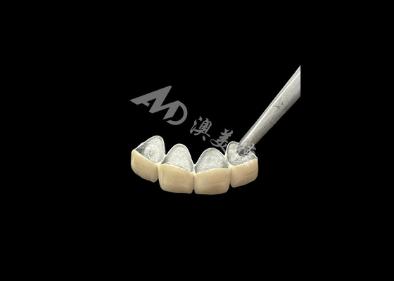 Bom preço Porcelana fundida com coroa de metal com maior resistência à corrosão on-line