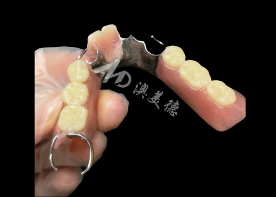 Bom preço Dentes parciais fundidos de titânio com pinças on-line