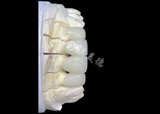 Bom preço Ponte de coroa cerâmica de zircônio de aparência natural proporciona precisão e estética combinadas on-line