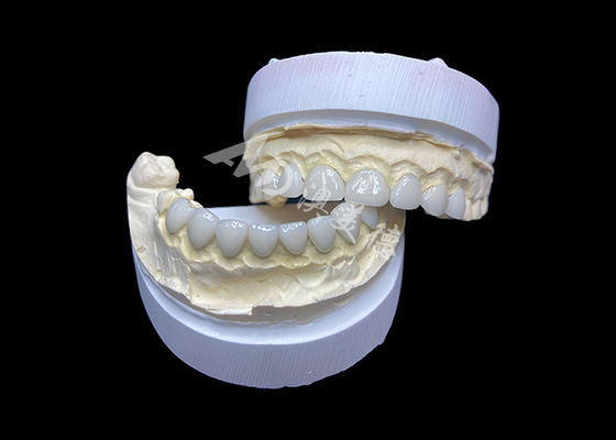 Bom preço Personalização Veneers cerâmicos de vidro ultra fino Alta translucidez para um sorriso natural on-line