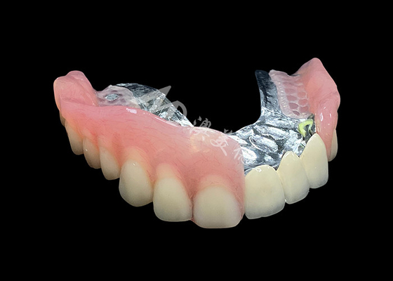 Bom preço Melhore Seu Sorriso Ponte da Coroa PFM de aparência natural e Dentaduras Removíveis on-line